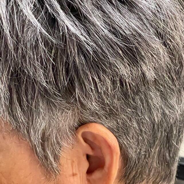 Human Gray Hair Topper.  Client: Severe Hair loss on top with short pixie cut. Topper matched and blended to her natural hair.